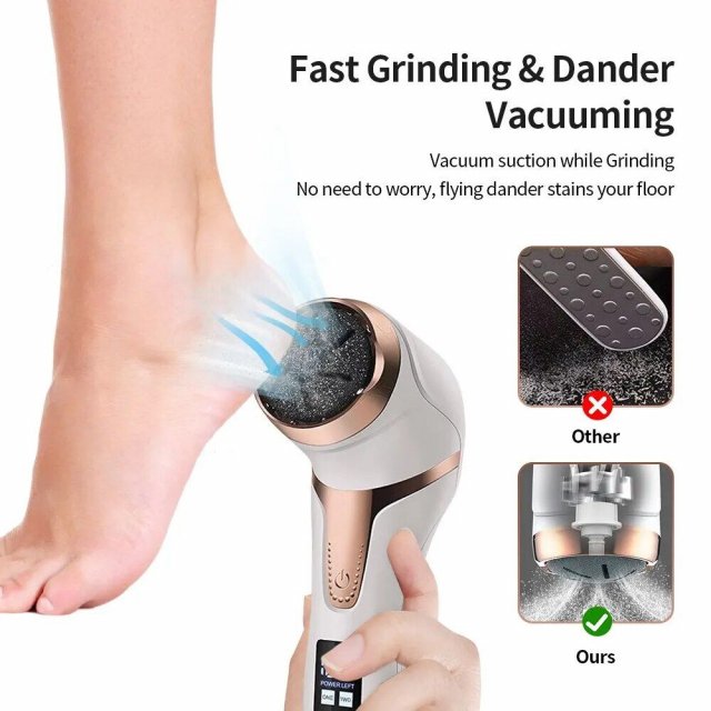 Rechargeable Electric Foot Callus Remover: Portable Pedicure Tool for Smooth Feet - Image 5