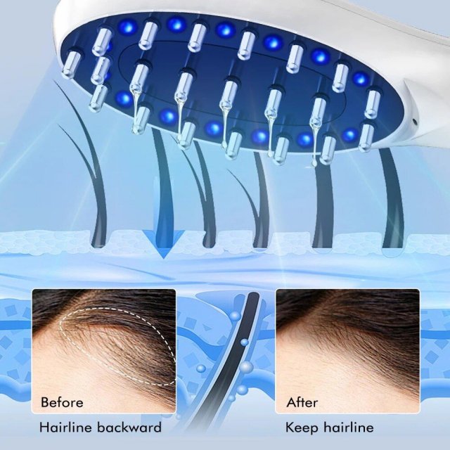 Electric Hair Growth and Scalp Health Massage Comb with Red/Blue Light Therapy - Image 7