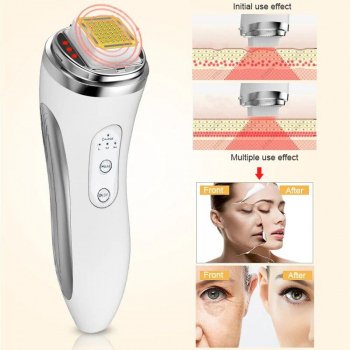 RF Radio Frequency Facial Rejuvenation Device: Dot Matrix Skin Tightening & Wrinkle Remover