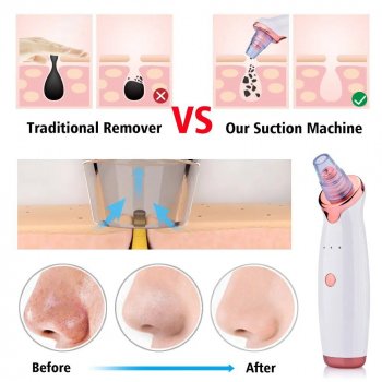 Electric Facial Vacuum Blackhead & Acne Remover with Deep Pore Cleaning Tools