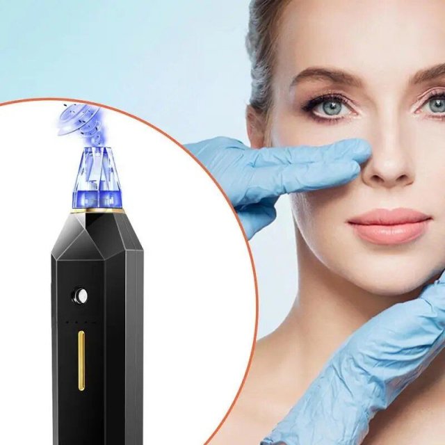 Electric Pore Vacuum with Dark Spot Removal & Oxygen Injection - Image 4