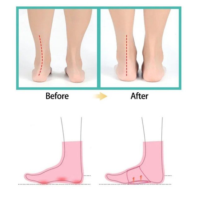 Ultimate Comfort Foot Arch Support Insoles - Orthopedic Pad for Flat Feet & Plantar Fasciitis Relief - Image 3